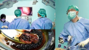Obat Alami Batu Empedu
