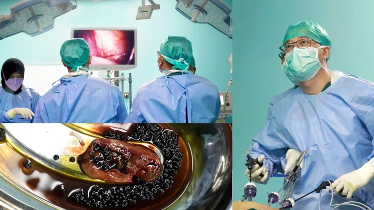 Obat Alami Batu Empedu