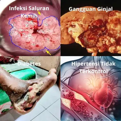Obat Kencing Berbusa